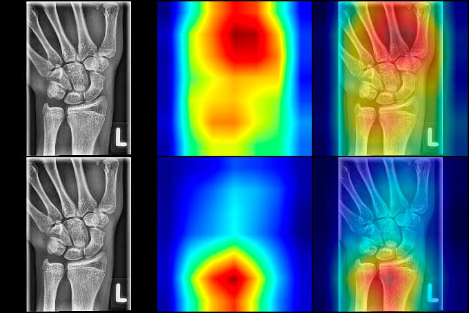 Heatmap